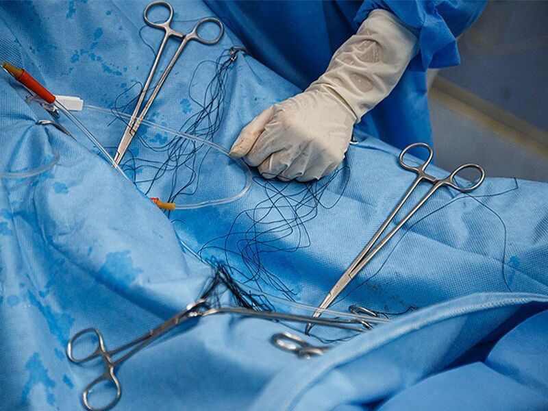 دلایل شکایت از جراح بینی توسط بیمار 3 شکایت از جراح بینی
